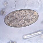 Fasciolopsis_buski_egg_08G0039_lores