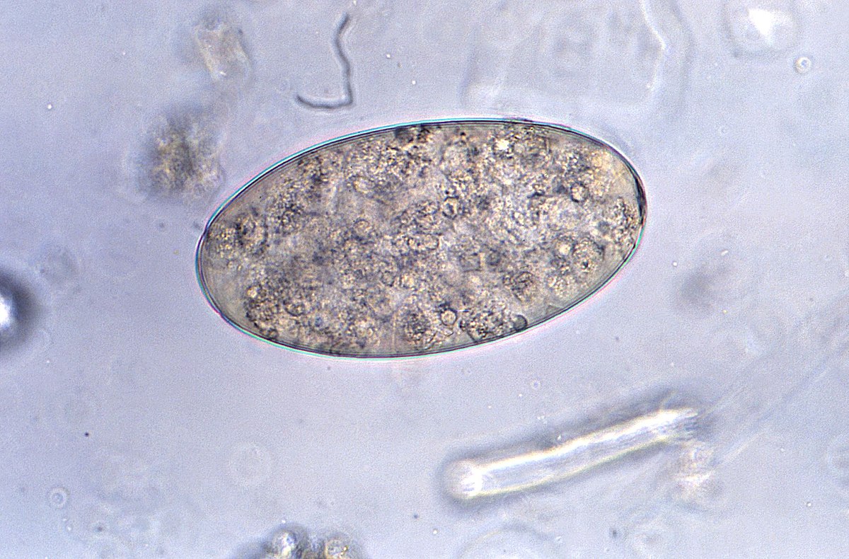 Fasciolopsis buski