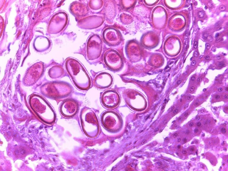 Gross-appearance-of-Liver-showing-Calodium-hepaticum-infection-Note-the-liver-contains