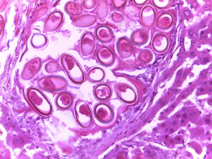 Calodium hepaticum