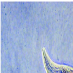 Photograph-of-the-Caenorhabditis-elegans-adult-hermaphrodite-Scale-bar-100-mm