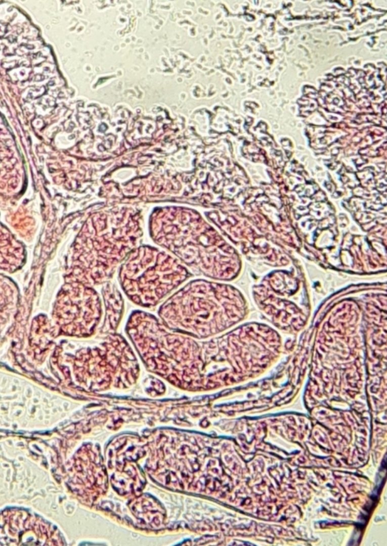 Fascioloides magna