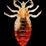 1200px-Body_lice
