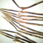 CSIRO_ScienceImage_10819_The_tail_ends_of_11_Haemonchus_contortus_barbers_pole_worm_adult_females_The_worms_are_all_taken_from_one_sheep_infected_with_a_single_strain_of_this_worm_species