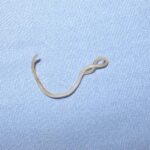 Canine_roundworm_1