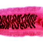 Clonorchis_sinensis_2