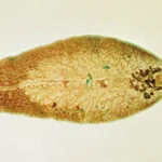 Liver-fluke.jpg