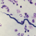 Loa loa – microfilaria