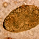 Paragonimus_westermani_01