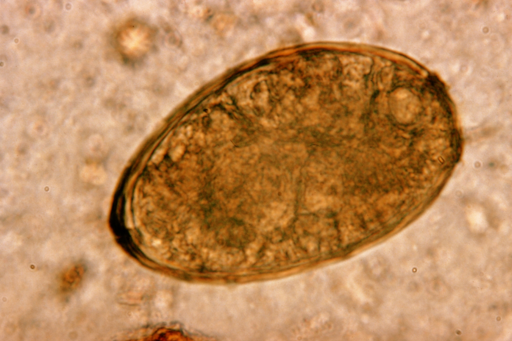 Paragonimus westermani