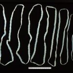 Taenia_saginata_adult_5260_lores