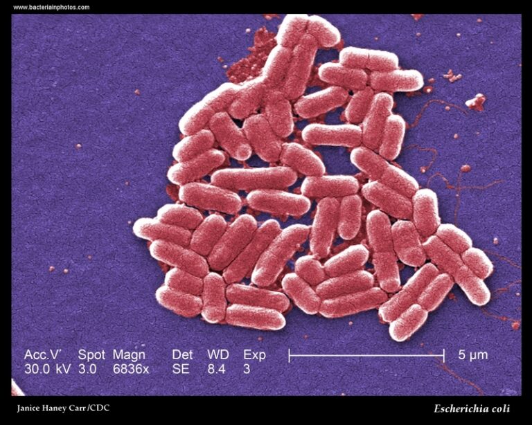 Escherichia coli