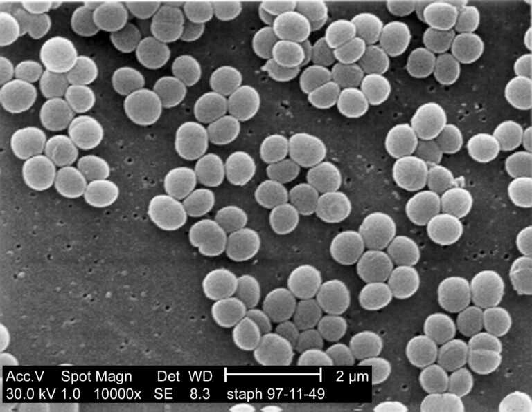 Staphylococcus aureus Staphylococcus aureus