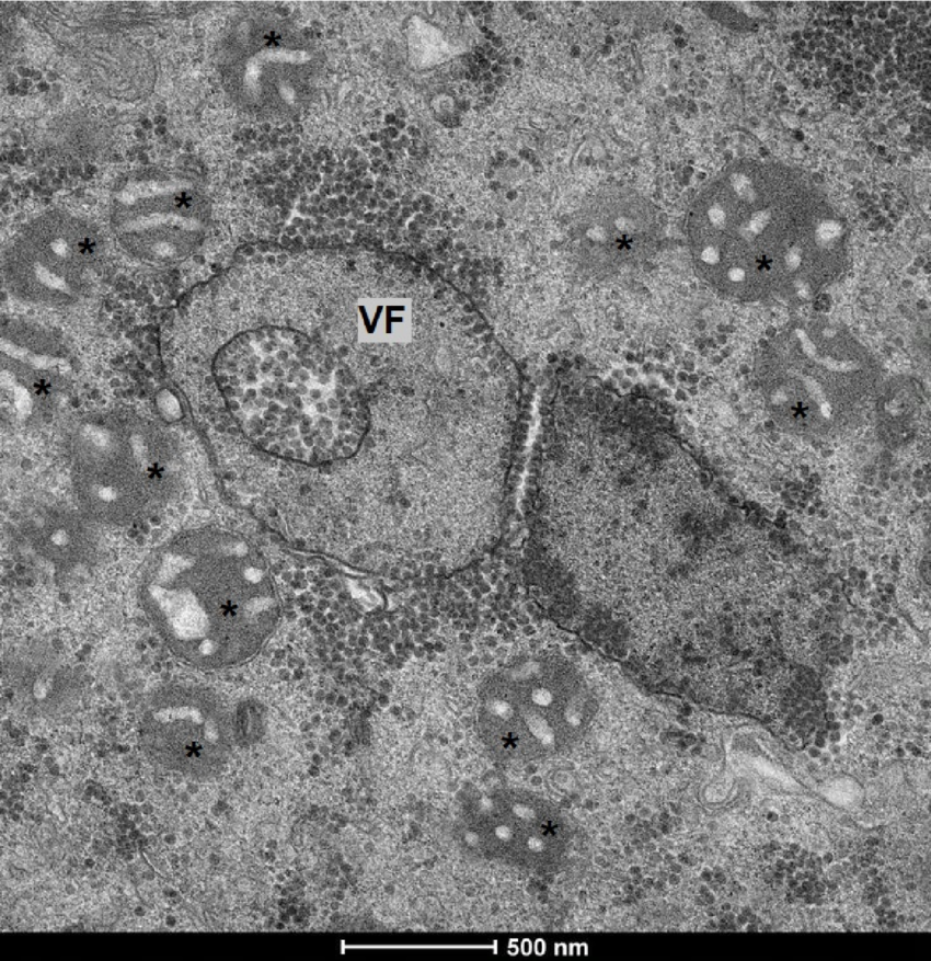Acanthamoeba castellanii