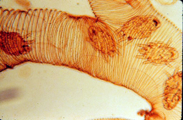Acarapis woodi
