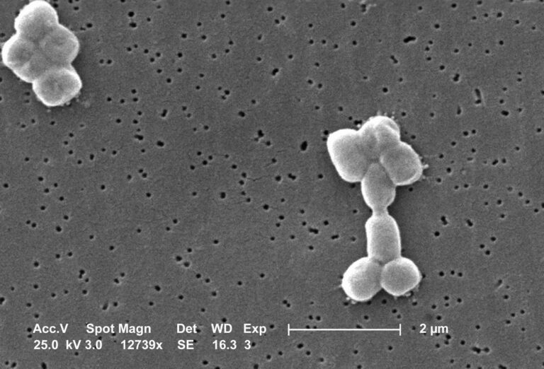 Acinetobacter baumannii