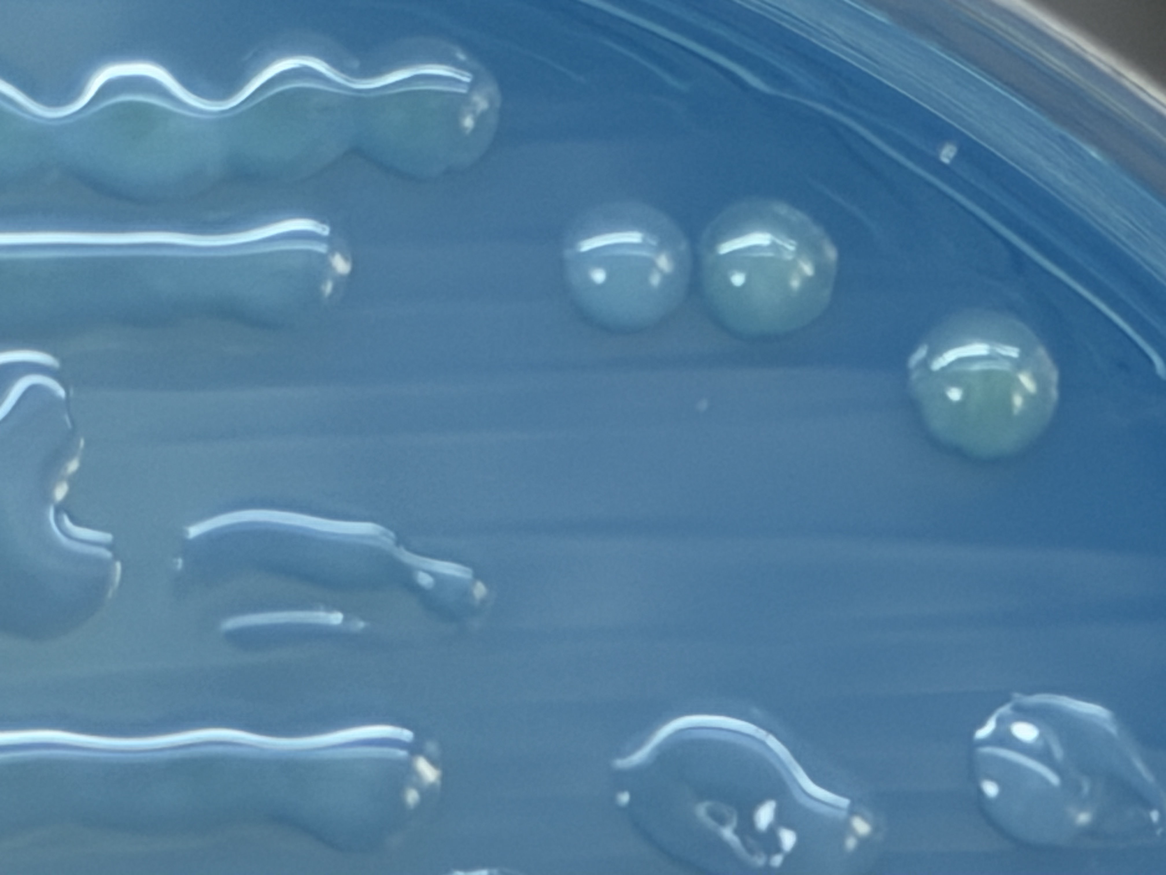 Acinetobacter lwoffii