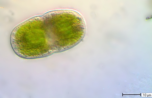 Actinotaenium cucurbita