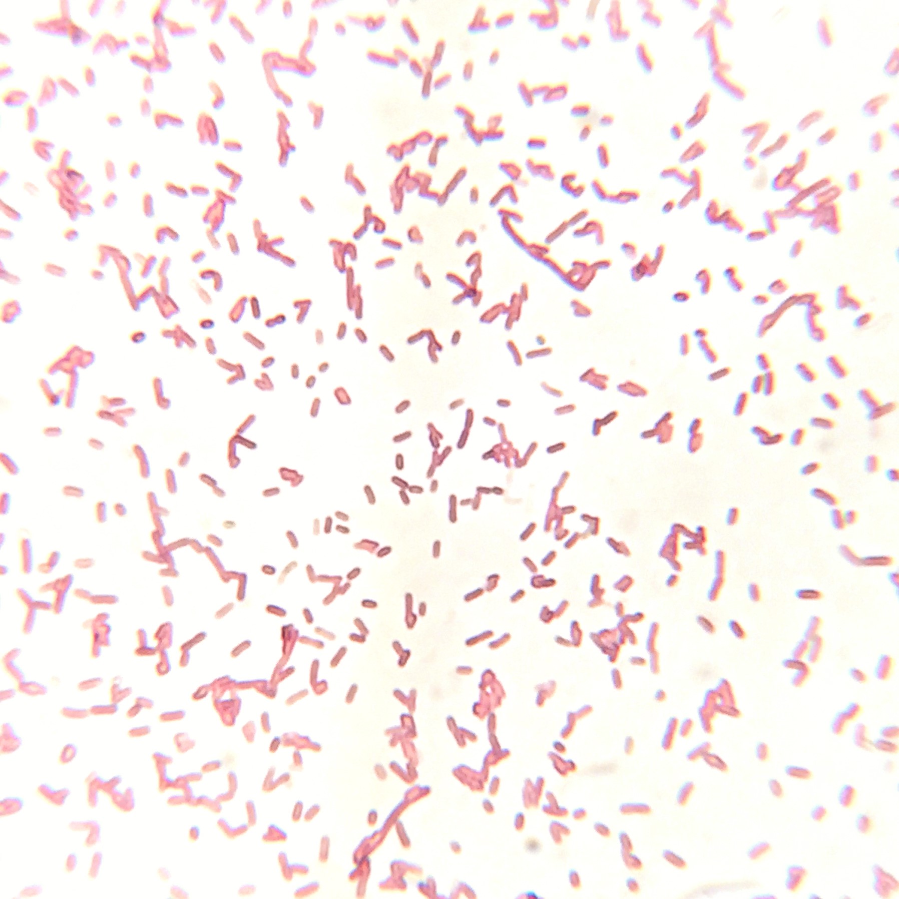 Aeromonas veronii