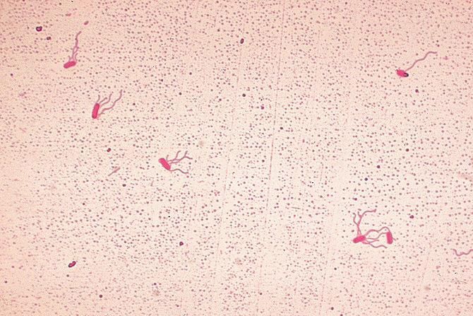 Alcaligenes faecalis