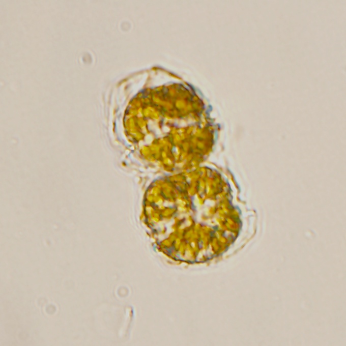 Alexandrium catenella