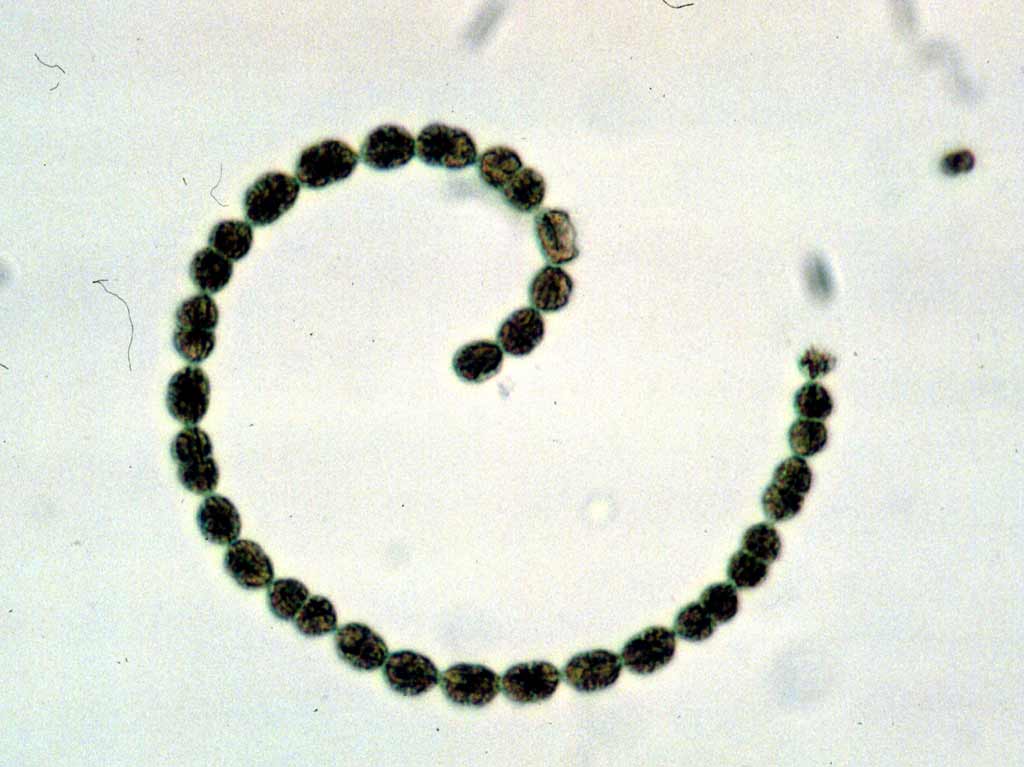 Anabaena flos-aquae / Dolichospermum flos-aquae