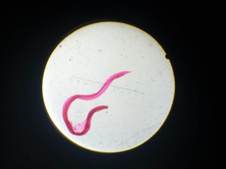 Ancylostoma duodenale