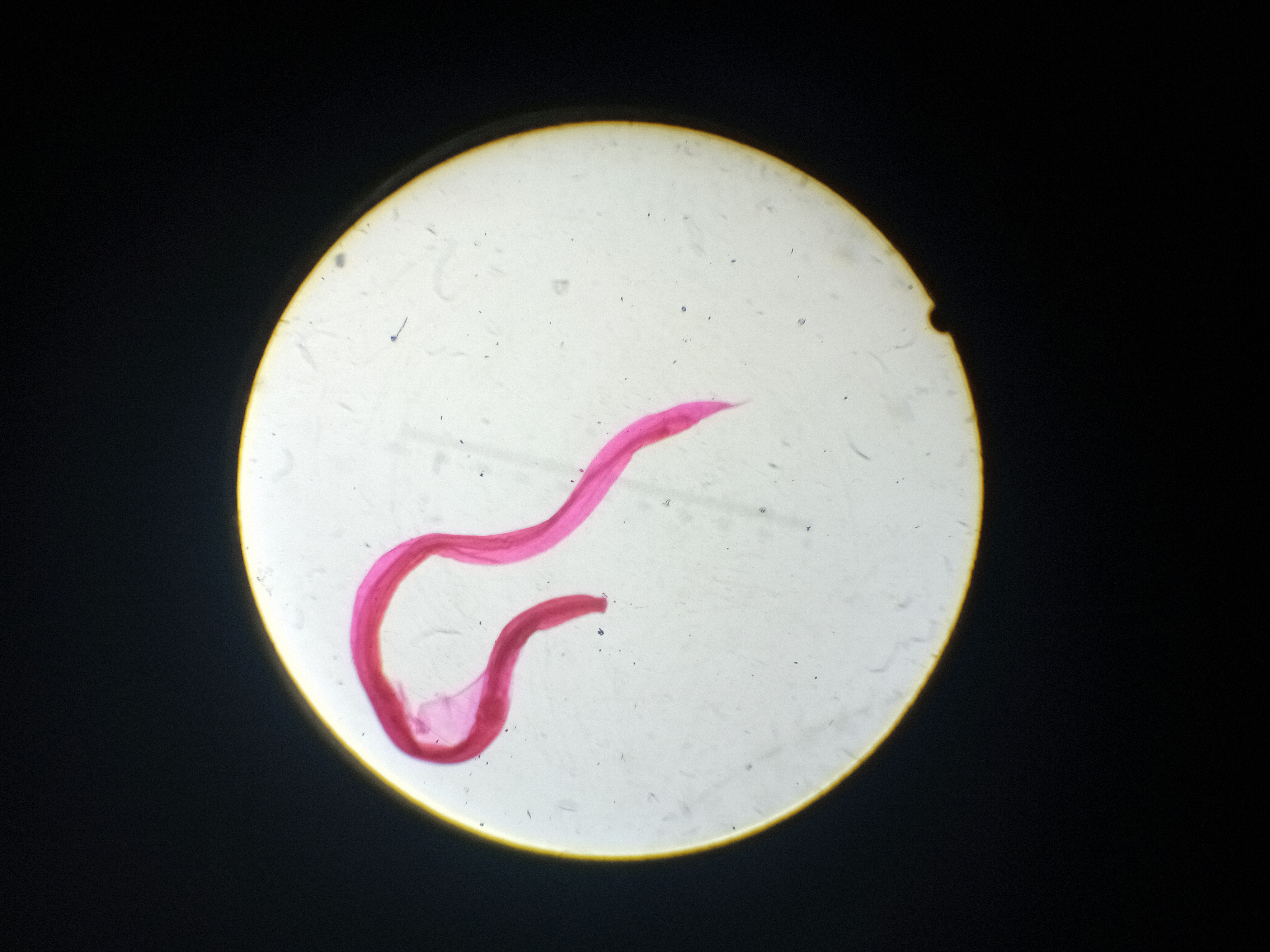 Ancylostoma duodenale