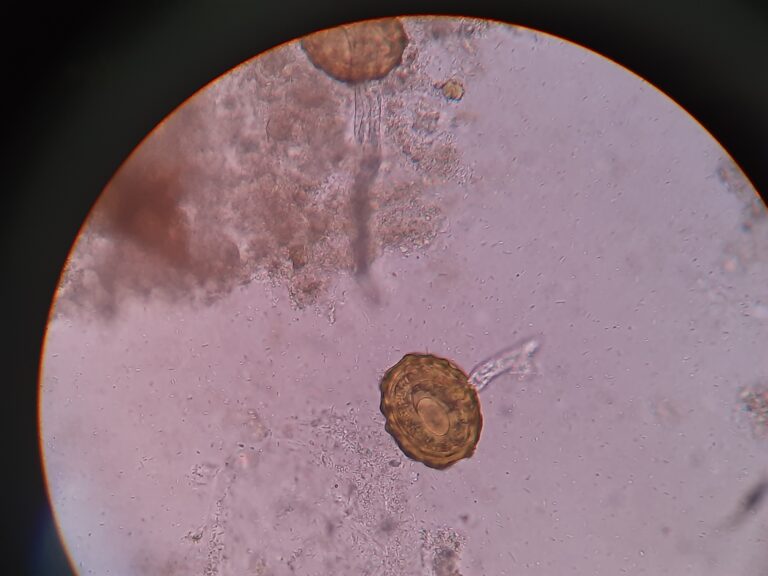 Ascaris lumbricoides