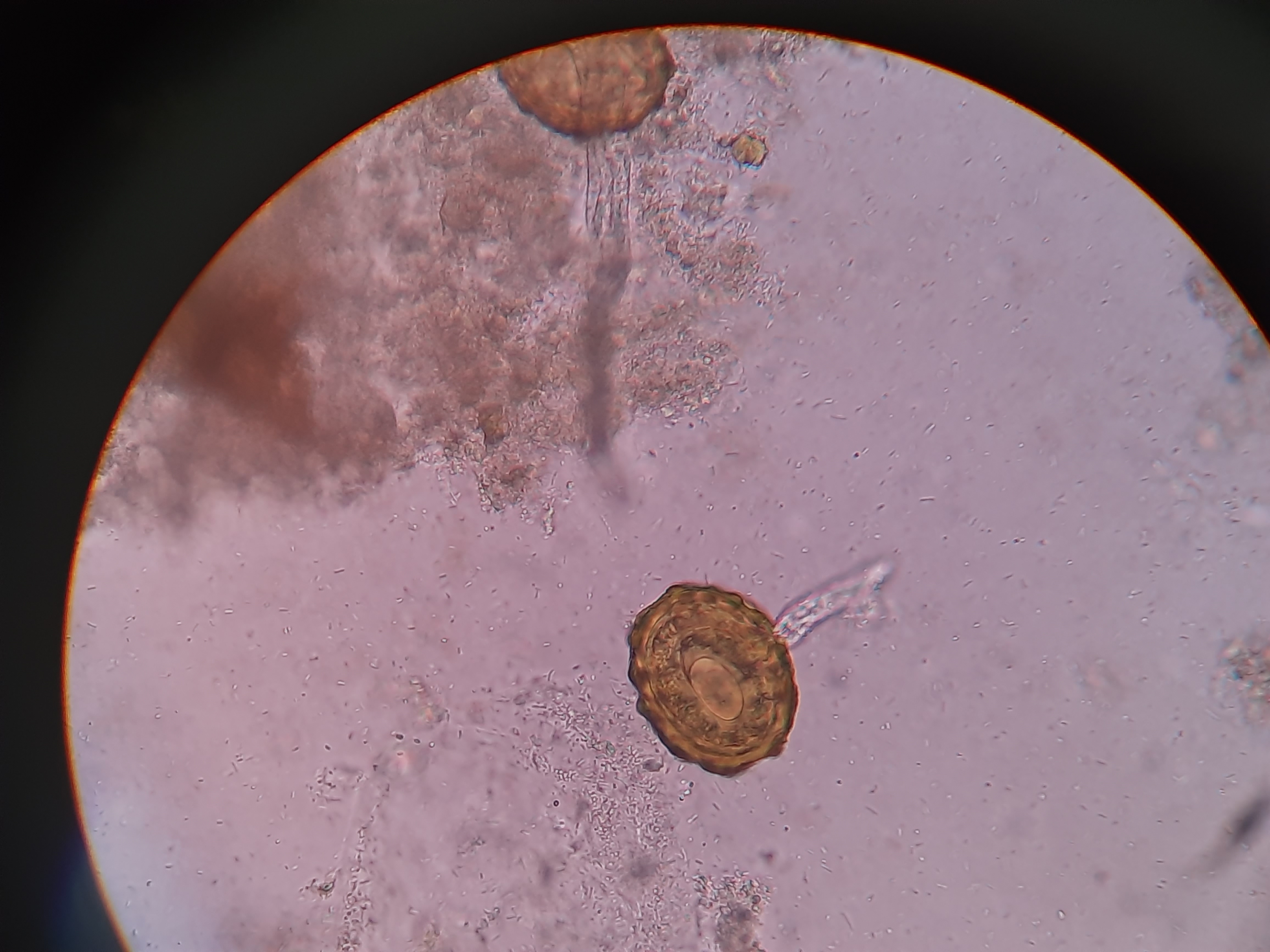 Ascaris lumbricoides
