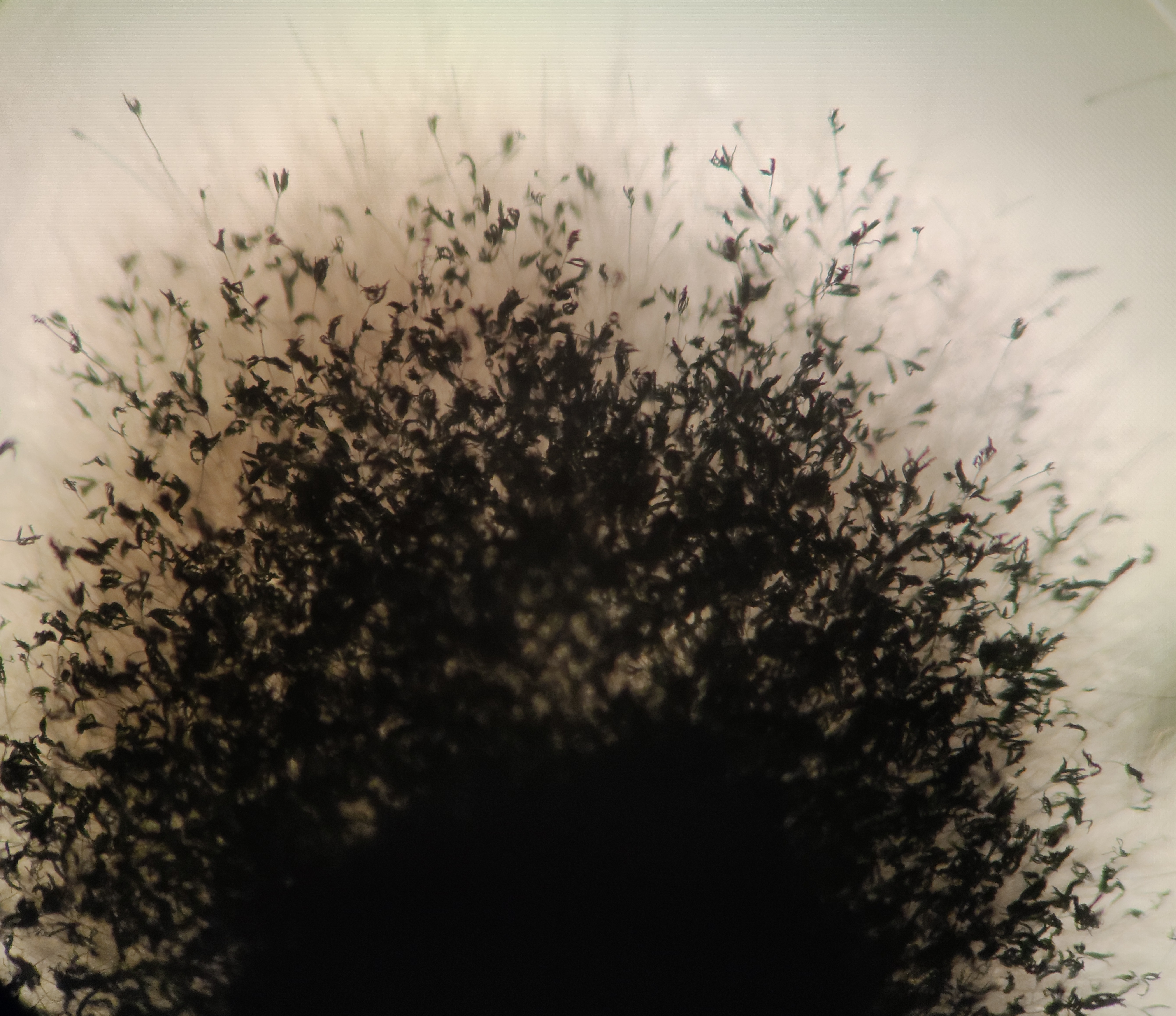 Aspergillus fumigatus