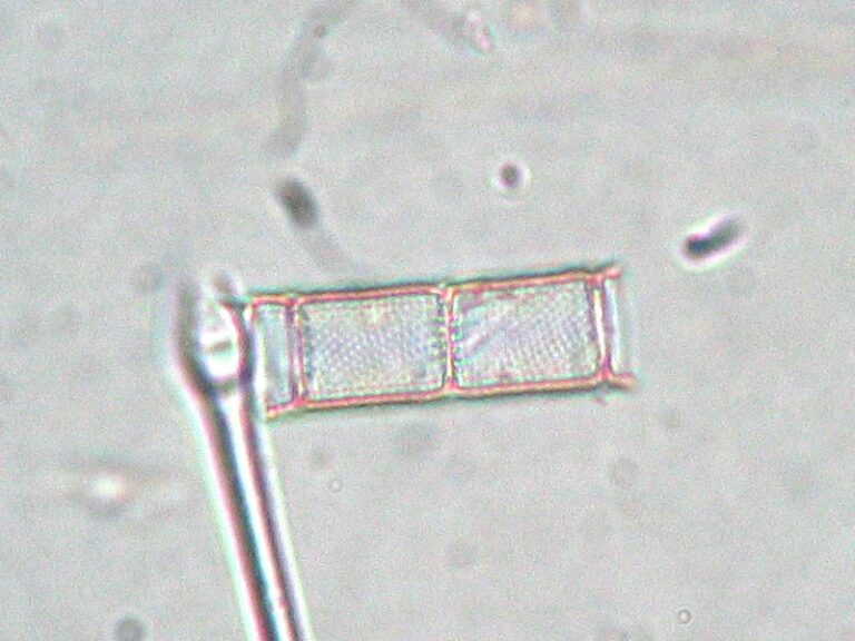 Aulacoseira ambigua