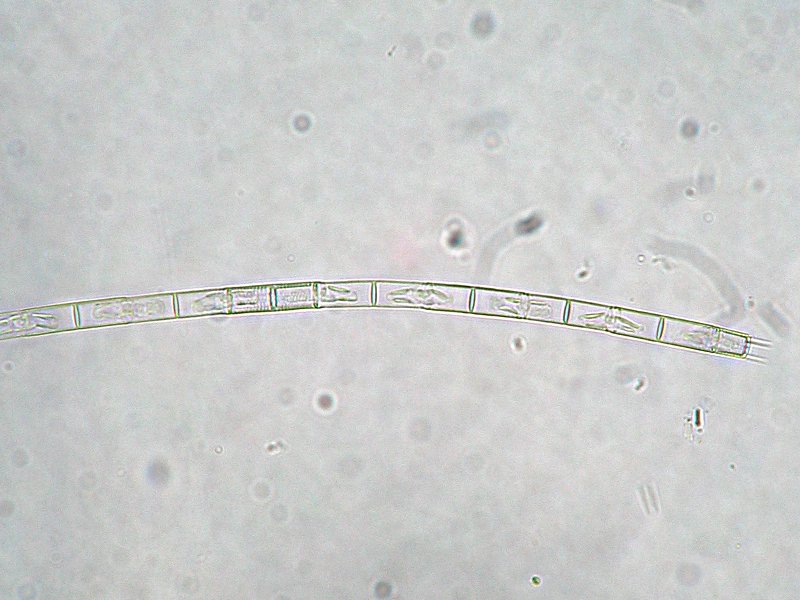 Aulacoseira granulata