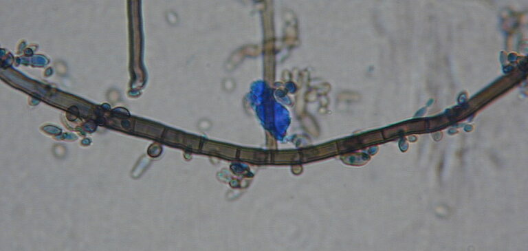 Aureobasidium pullulans Aureobasidium pullulans
