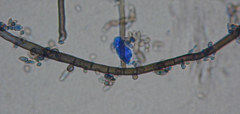 Aureobasidium pullulans