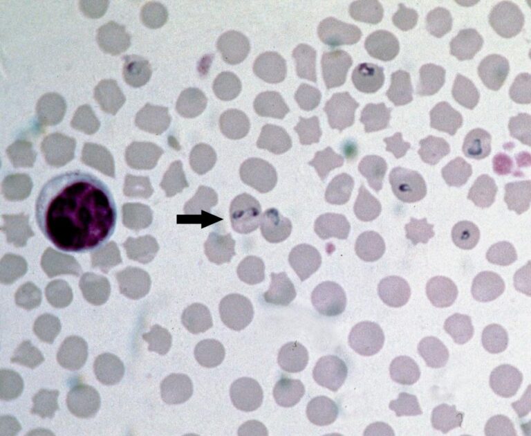 Babesia bovis