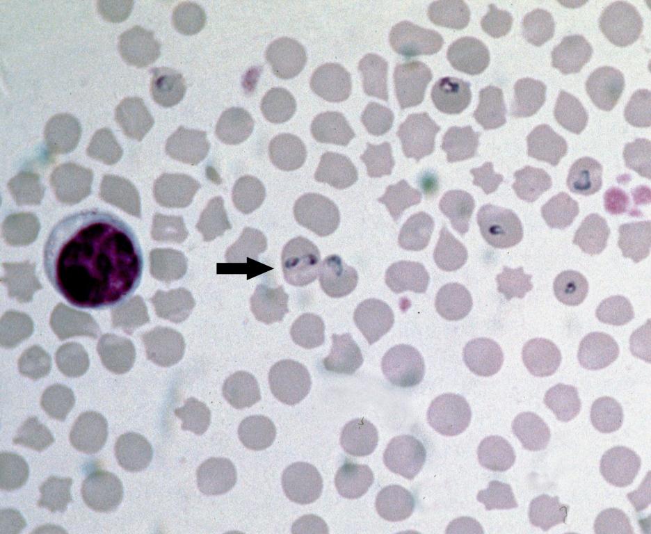 Babesia bovis