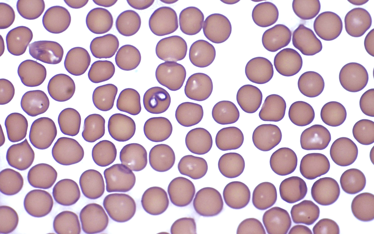 Babesia canis
