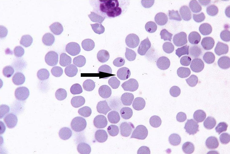 Babesia divergens