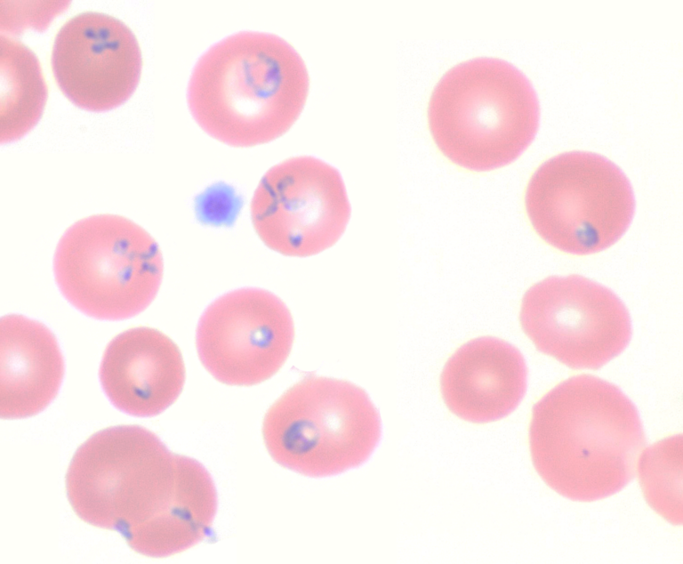 Babesia microti