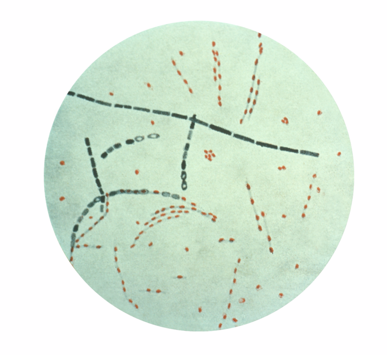 Bacillus anthracis Bacillus anthracis