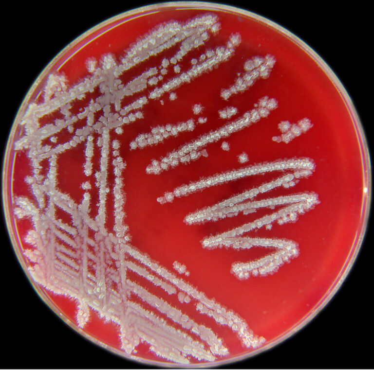 Bacillus licheniformis Bacillus licheniformis