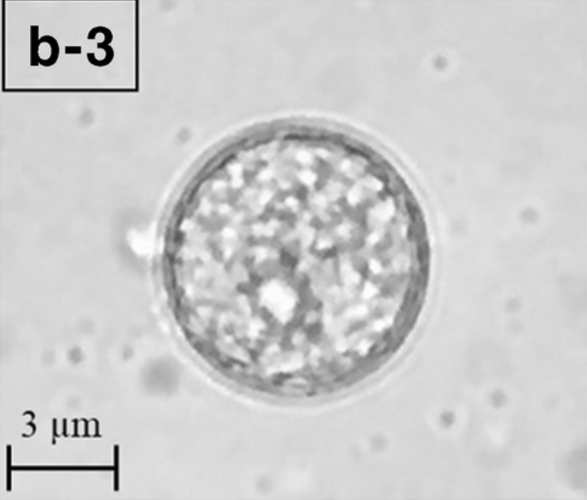 Balamuthia mandrillaris