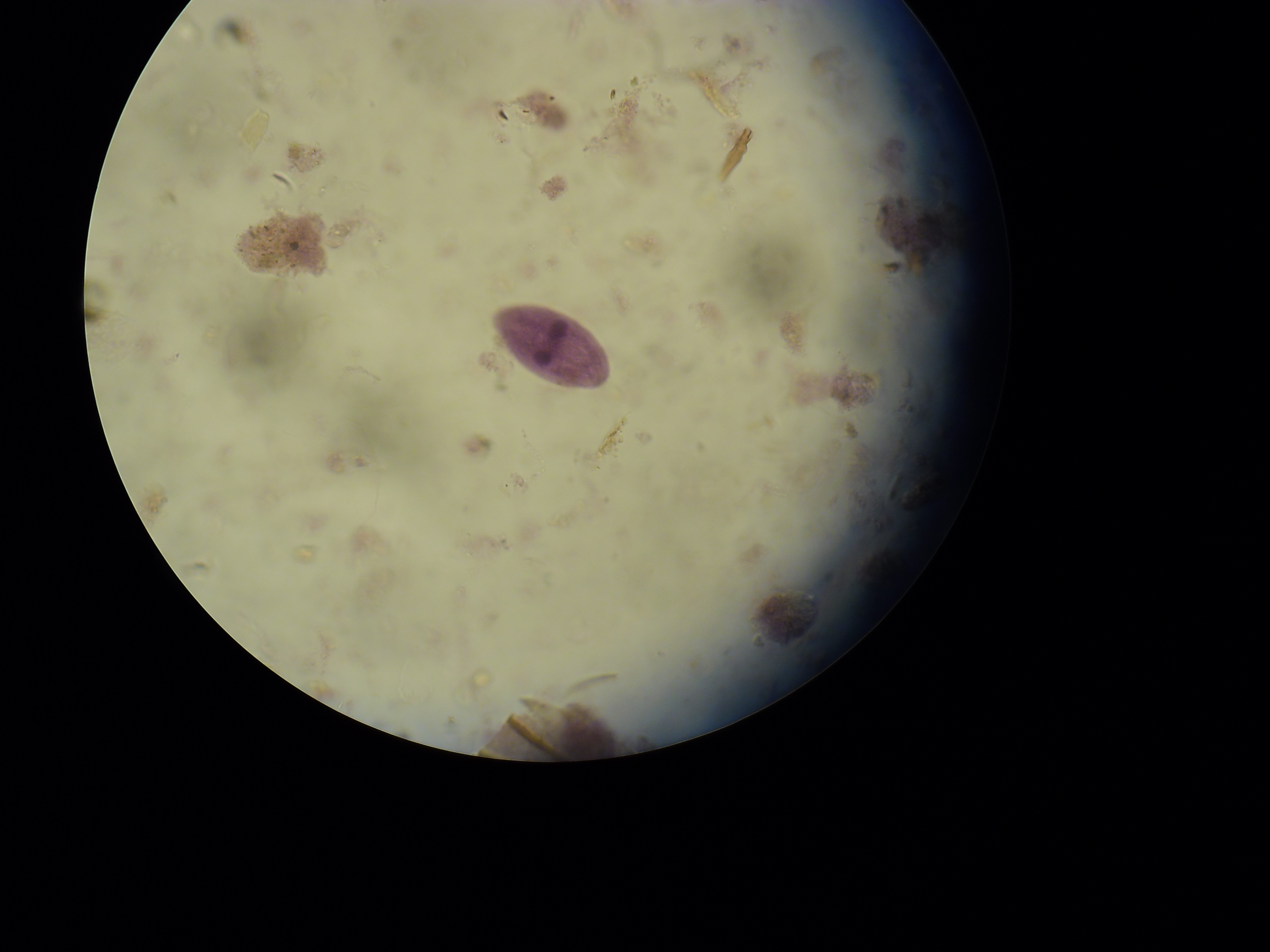 Balantioides coli