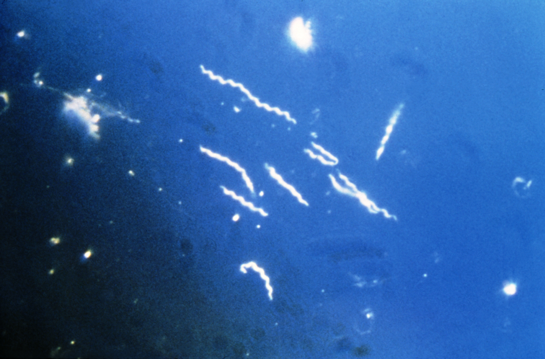 Borrelia (Borrelia)