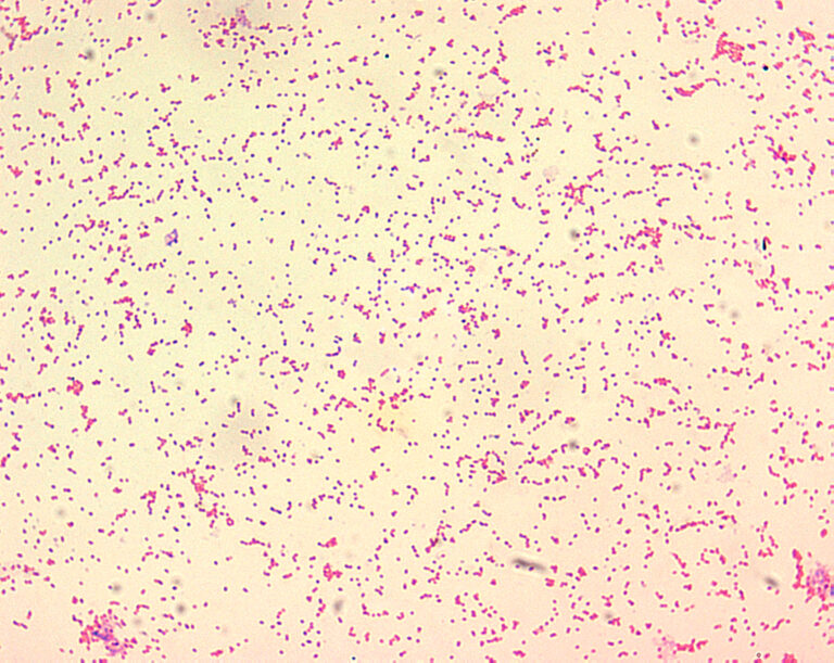 Brucella abortus