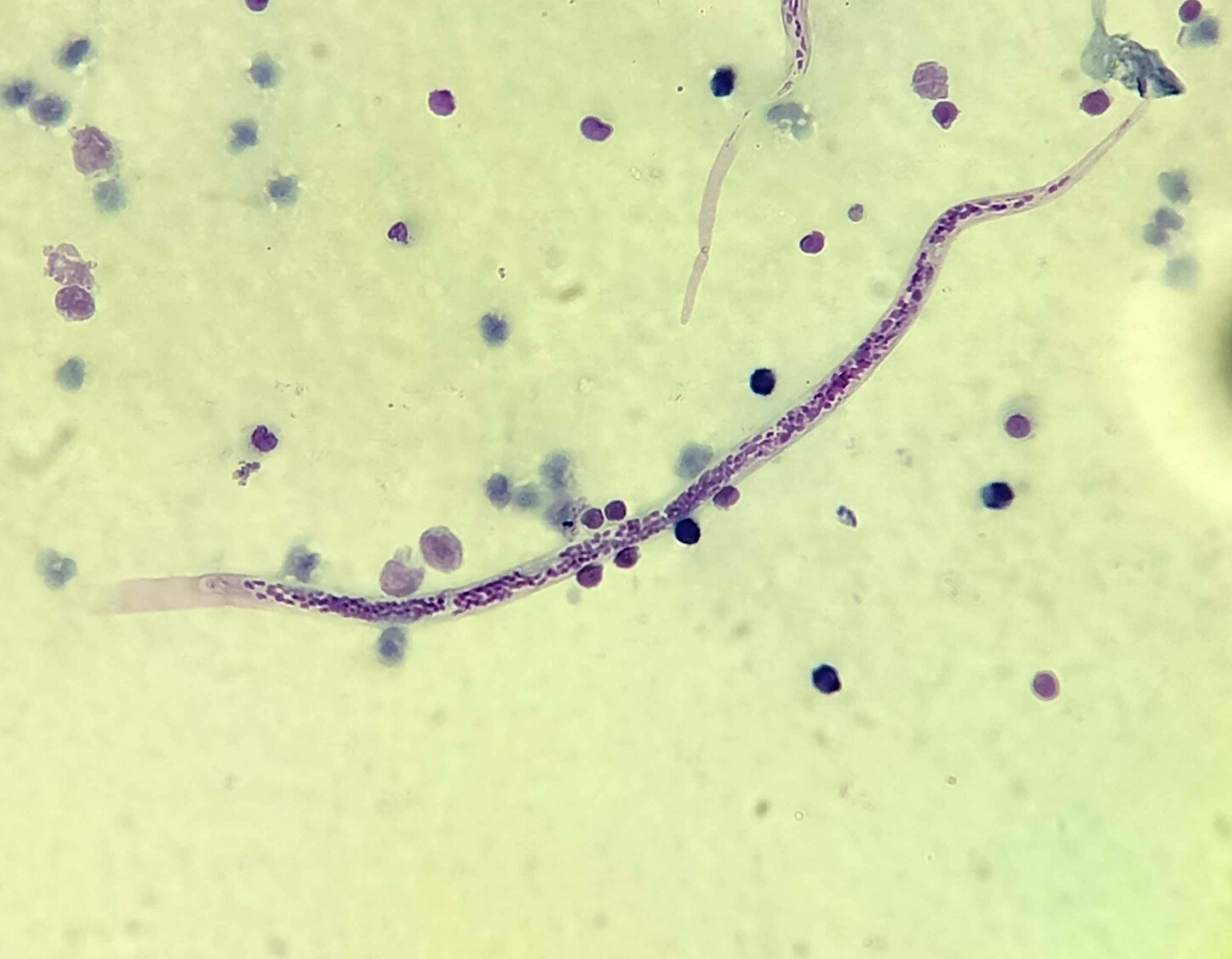 Brugia malayi