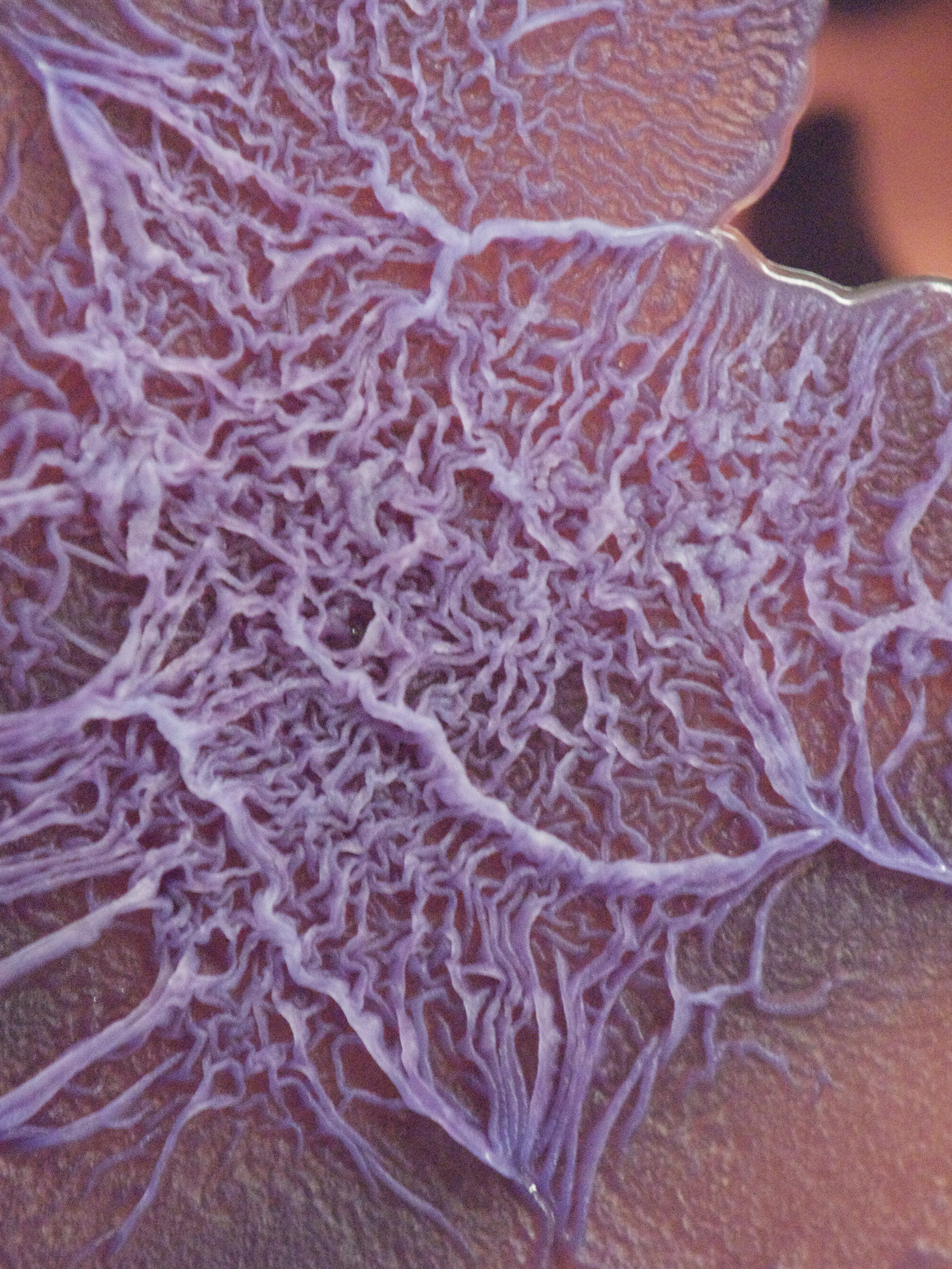 Burkholderia thailandensis