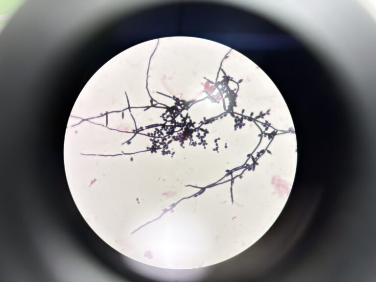 Candida albicans