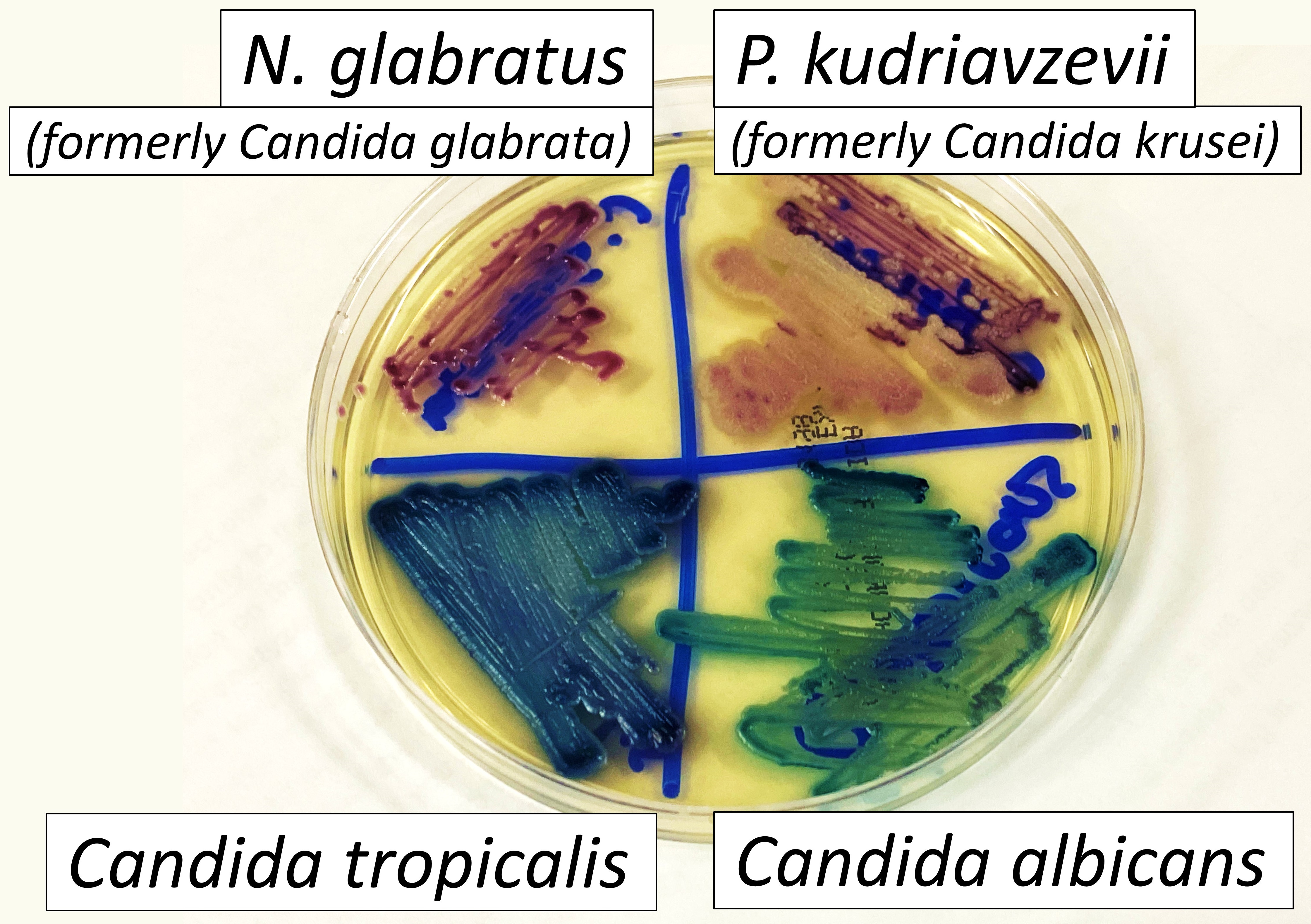Candida tropicalis